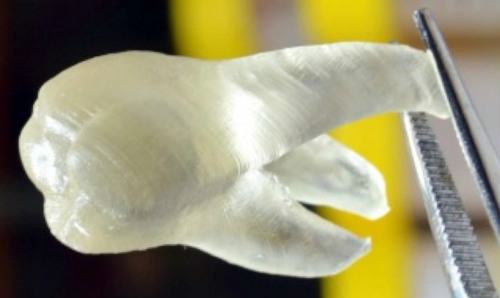 Зубы, распечатанные на 3-D принтере, уменьшают количество бактерий в ротовой полости